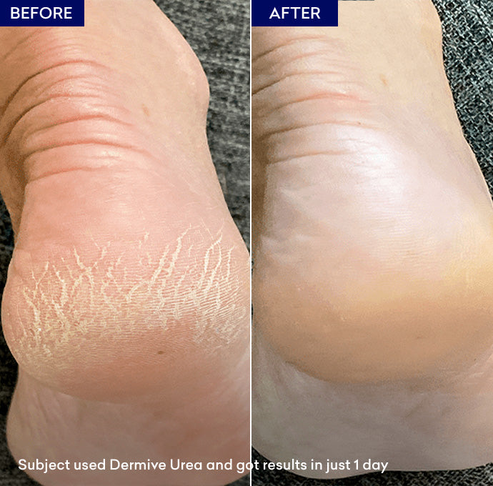 Show Dermive Urea