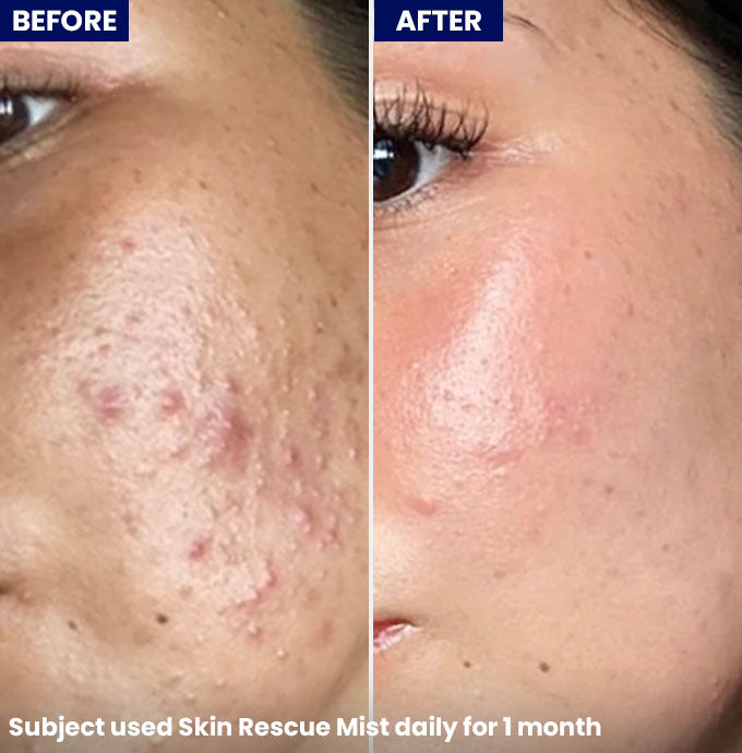 Show Skin Rescue Mist