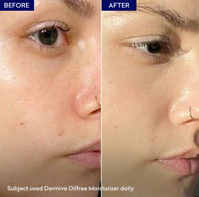 Show Dermive Oil Free Moisturizer