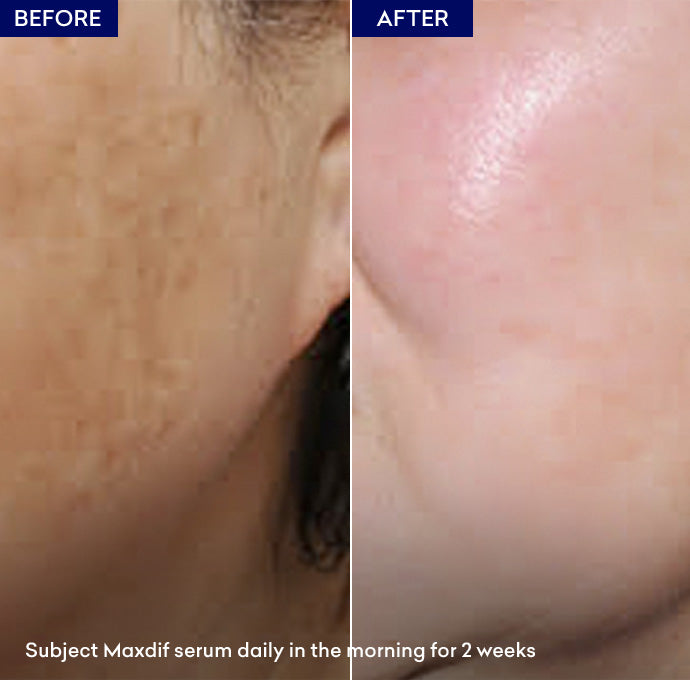 Show best skin brightening serum