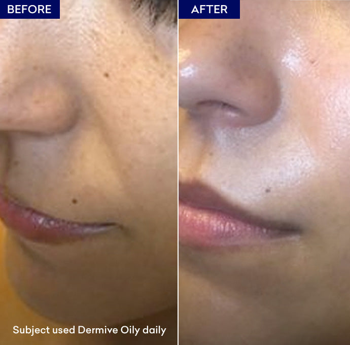 Show Dermive Oily