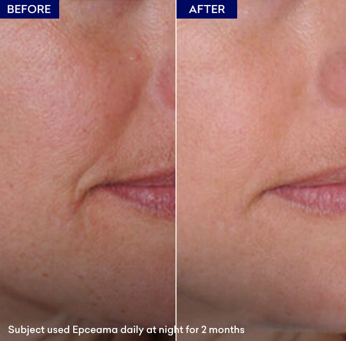Show wrinkle serum