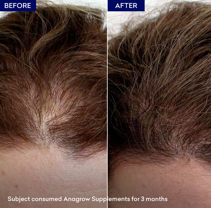 Show hair growth capsules