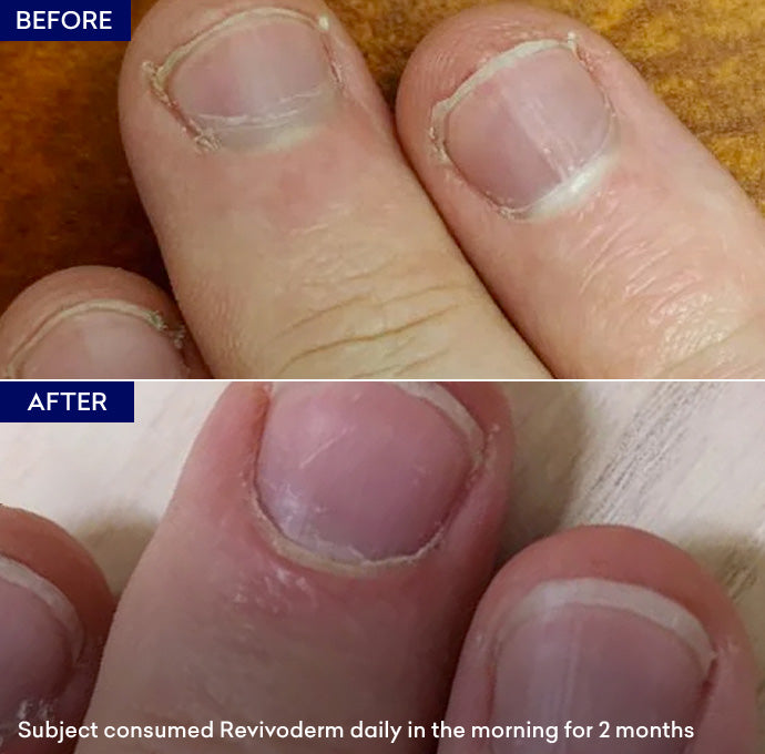 Show vitamins for hair and nails