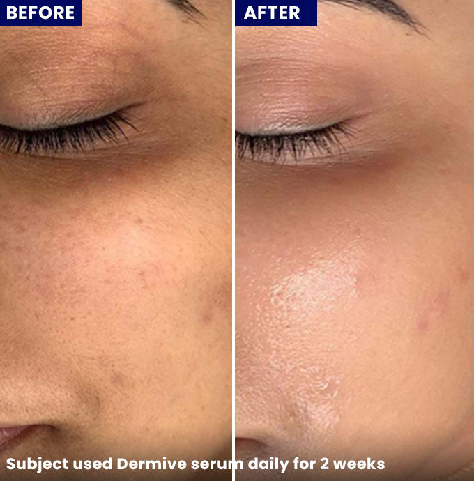 Show Dermive Hydrating Serum