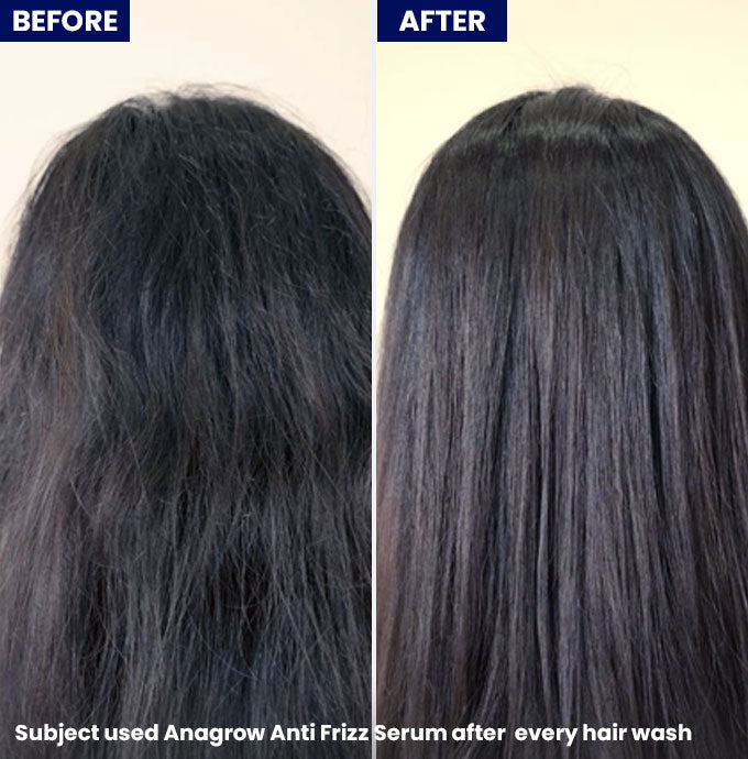 Show Anagrow Anti Frizz Hair Serum