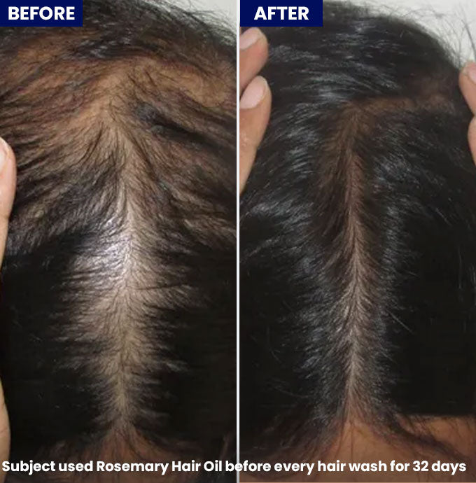 Show Anagrow Rosemary Hair Oil