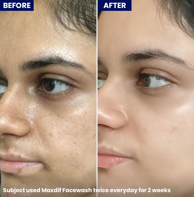 Show Maxdif Facewash
