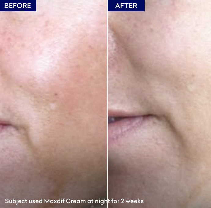 Show whitening cream