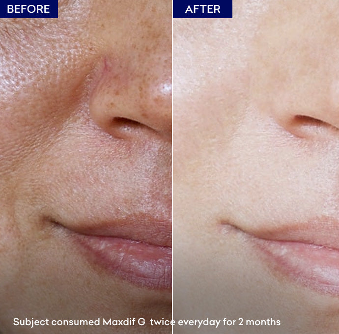 Show whitening capsule