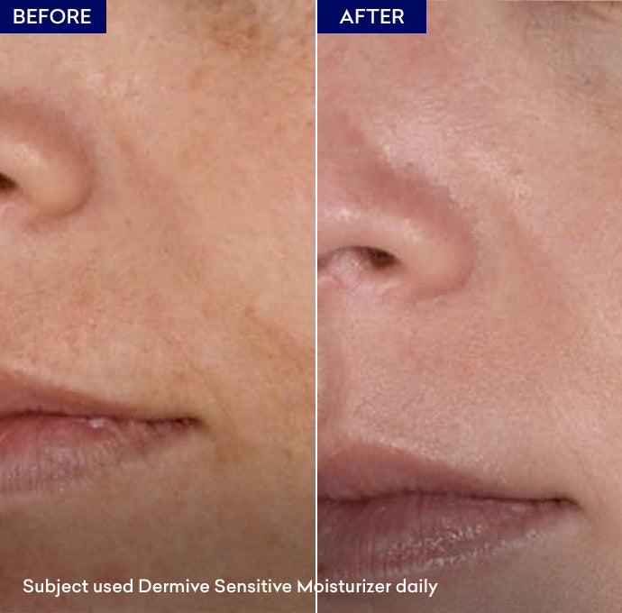 Show Dermive Sensitive Moisturizer