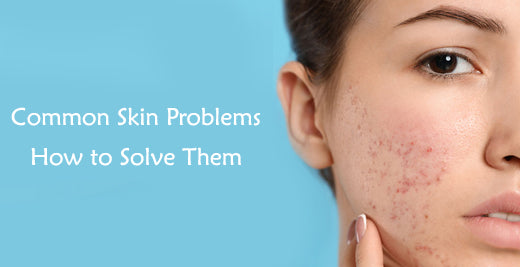 Common Skin Problems and How to Solve Them