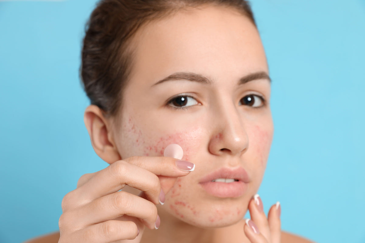 Does Salicylic Acid Face Wash Really Clear Acne? Dermatologist Explains