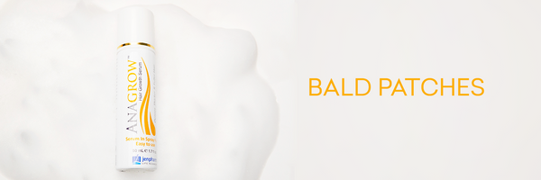 Bald Patches
