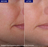 Epceama Anti Aging Serum