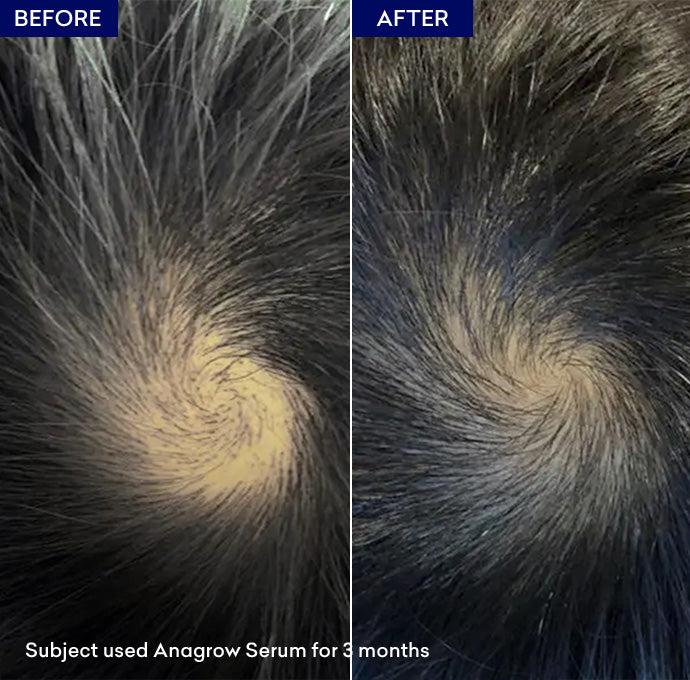 Show Anagrow Hair Serum
