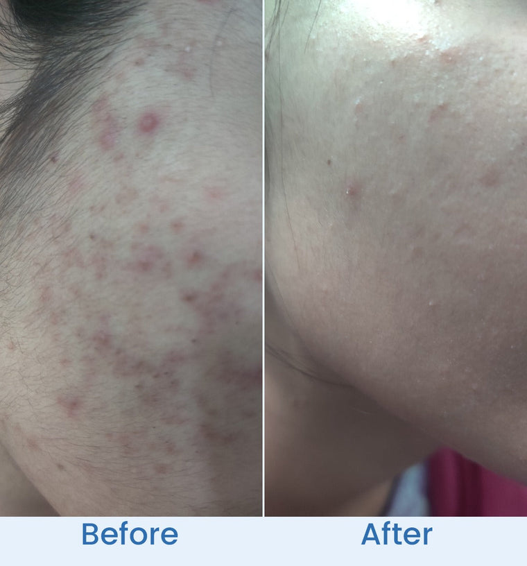 Arooba before and after