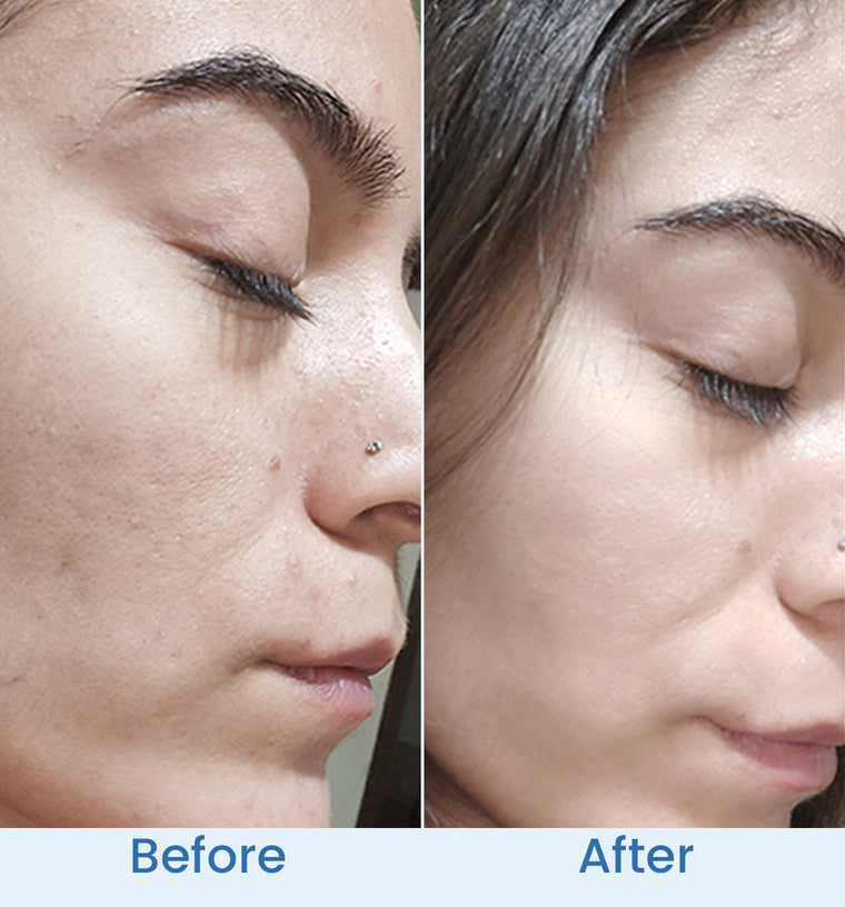 Zoha before and after