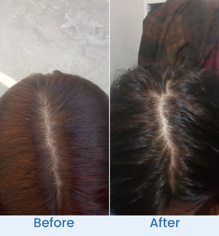 Mehak before and after