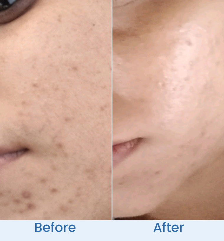Faiza before and after