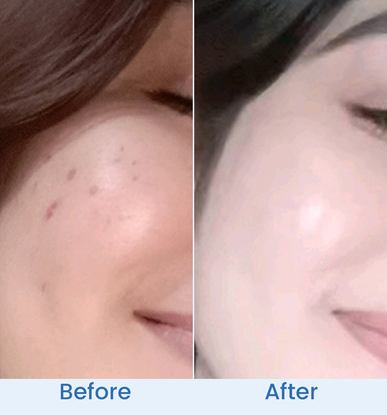 Mishal before and after