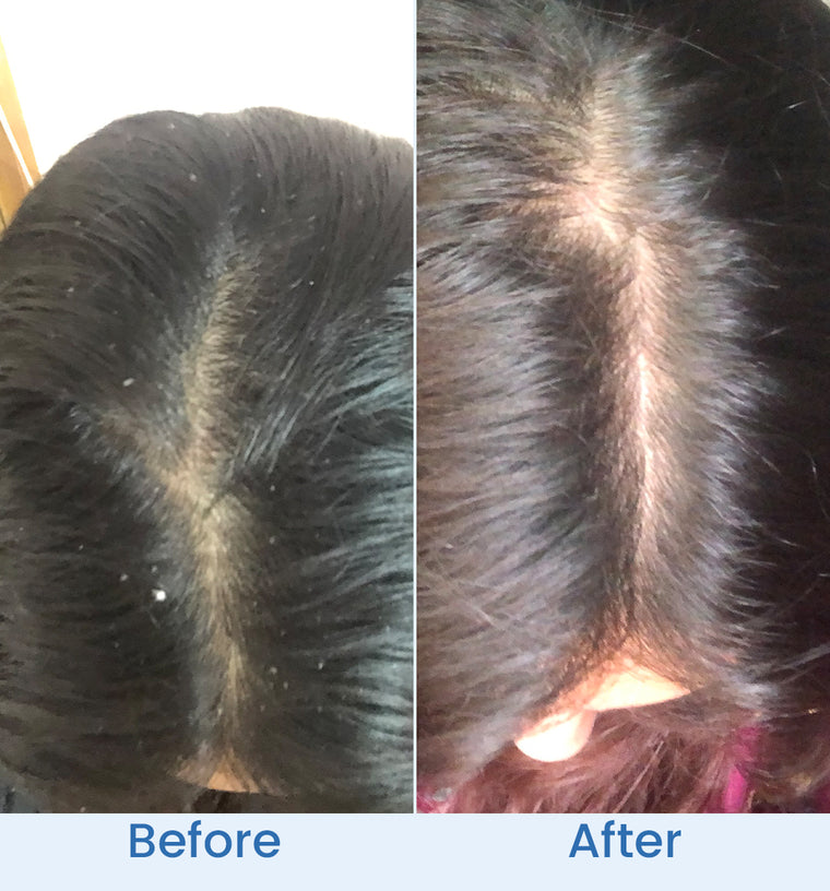 Amna before and after