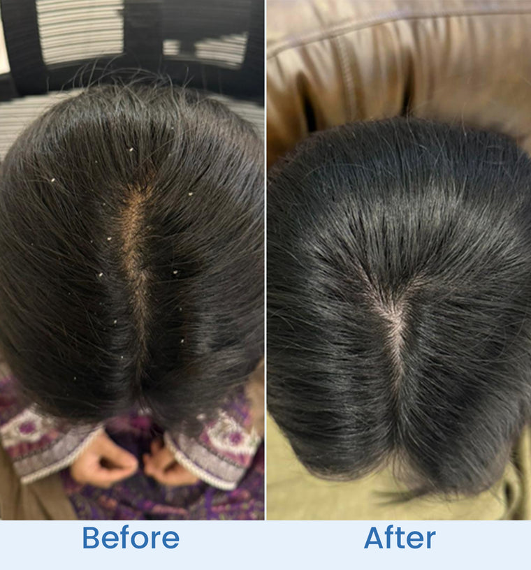 Minahil before and after