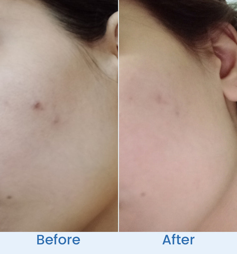 Maryam before and after