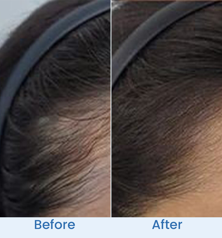 Fatima before and after