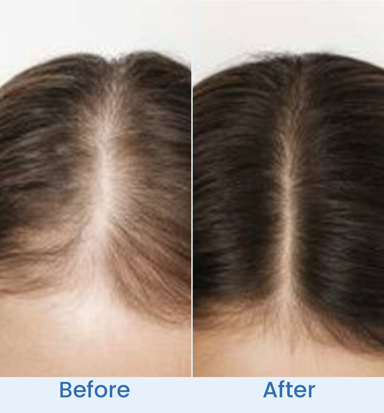 Maha before and after