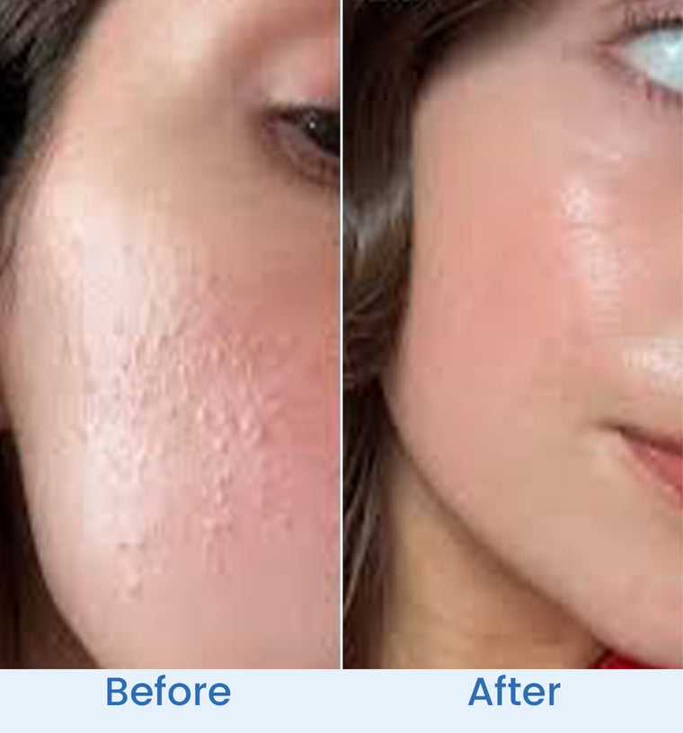 Alina before and after
