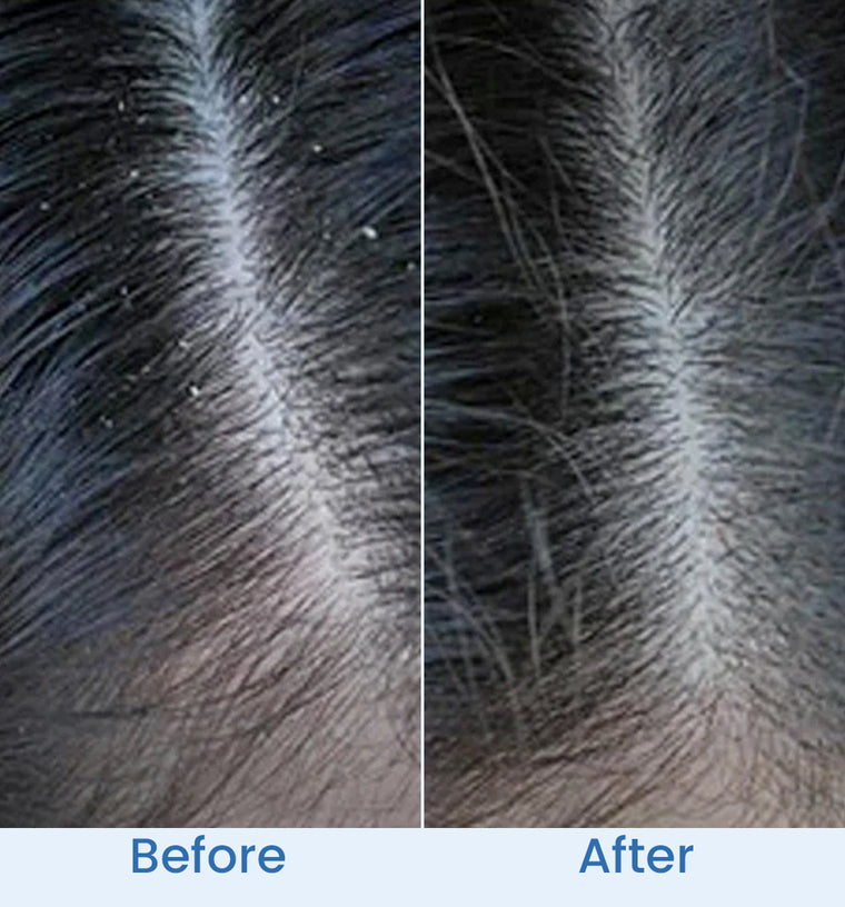 Farwa before and after