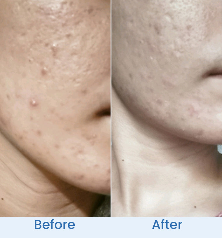 Saira before and after