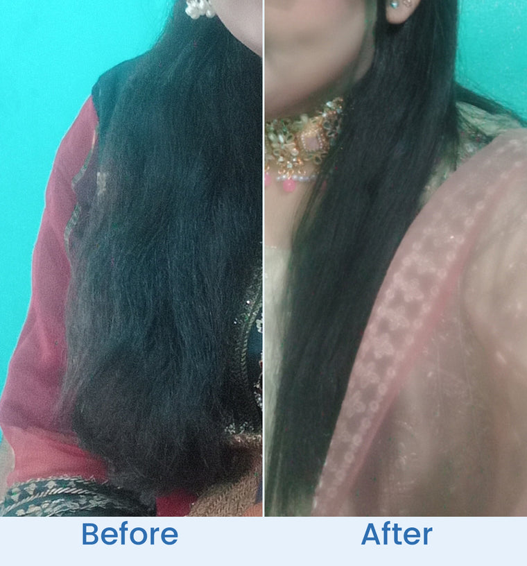 Nida before and after