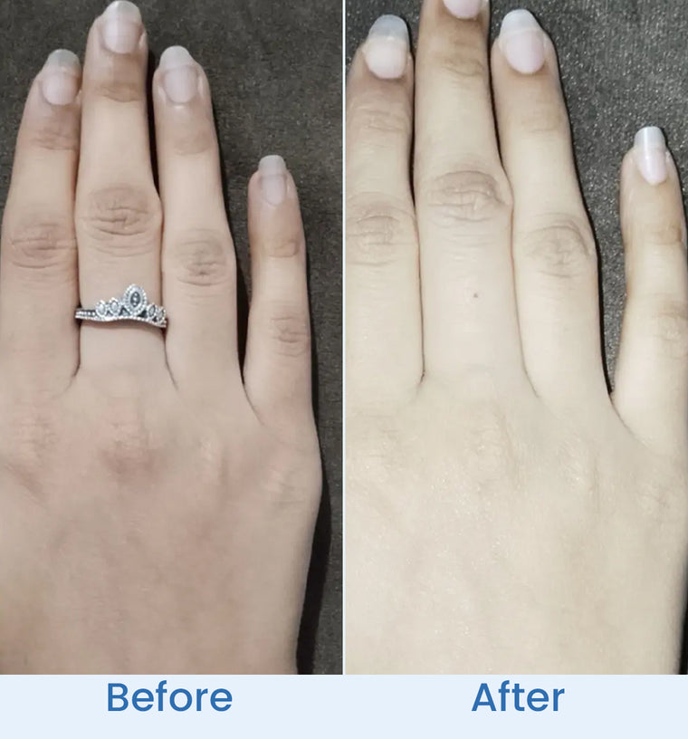 Aroobe before and after