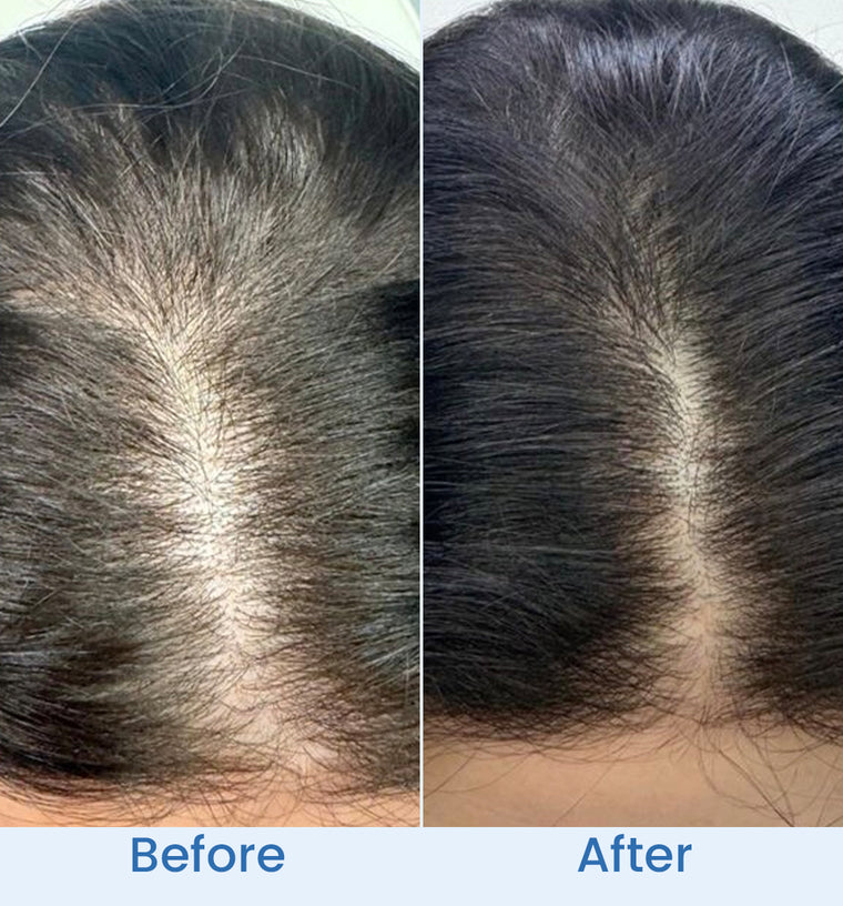 Laiba before and after