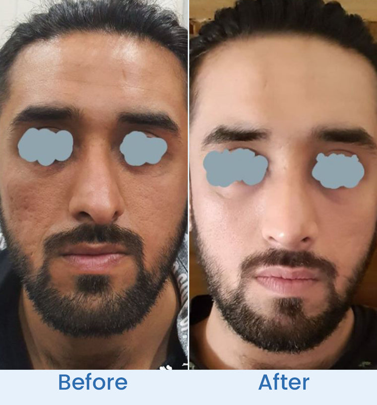 Shahid before and after