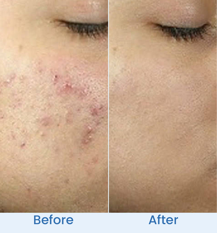 Sadia before and after
