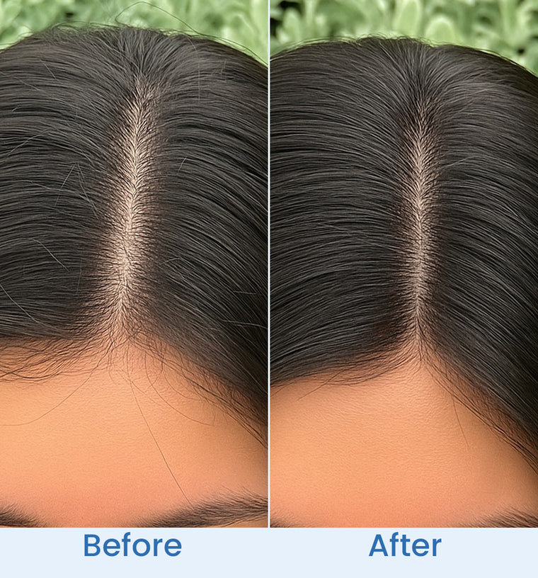 Hina before and after
