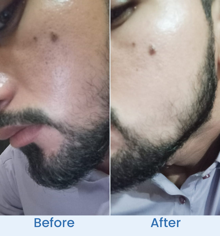Ahmad before and after