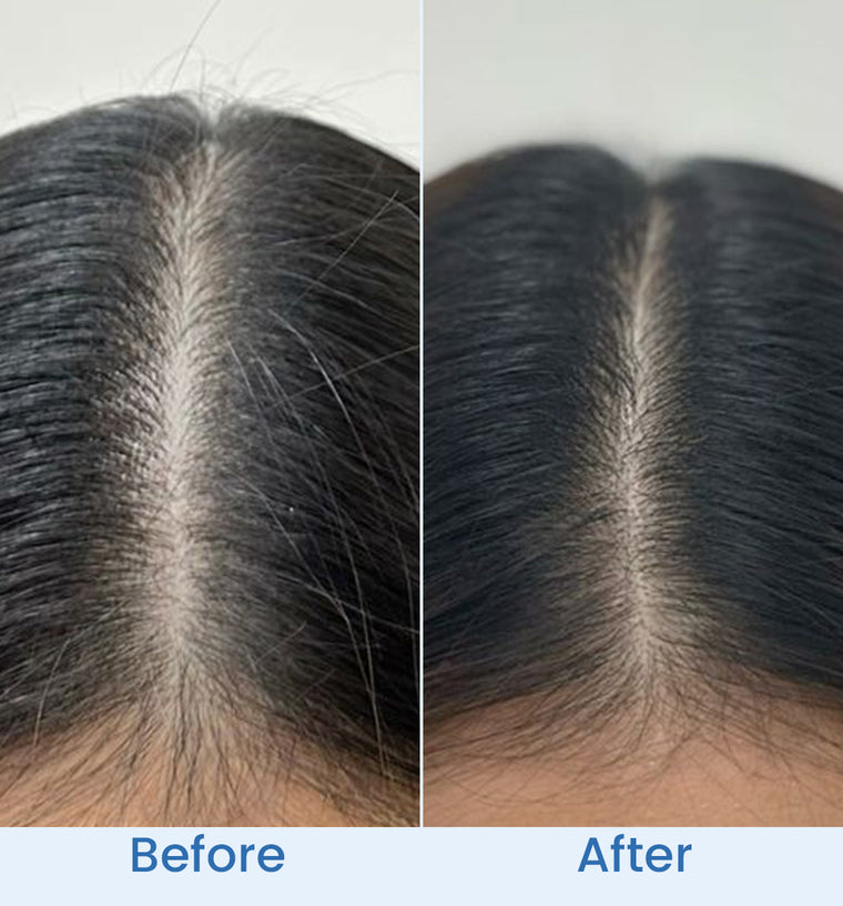 Noureen before and after
