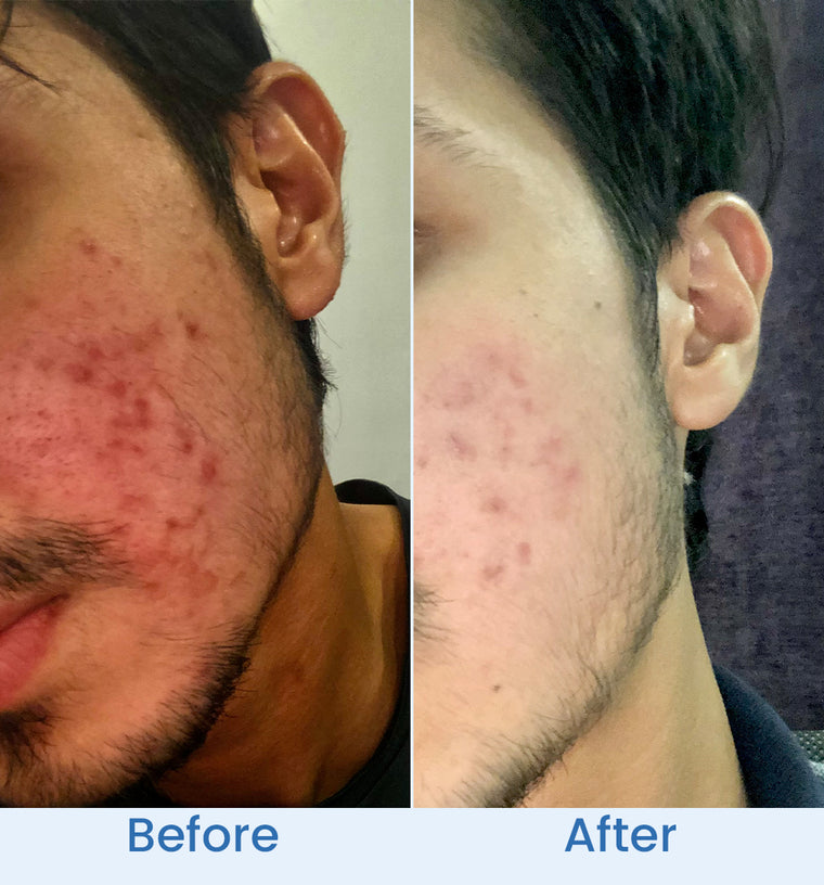 Ali before and after