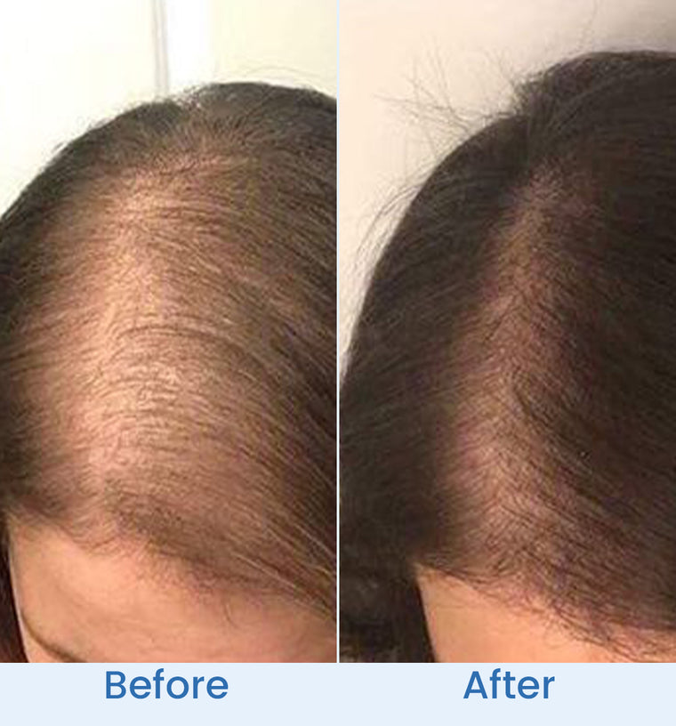 Shazia before and after