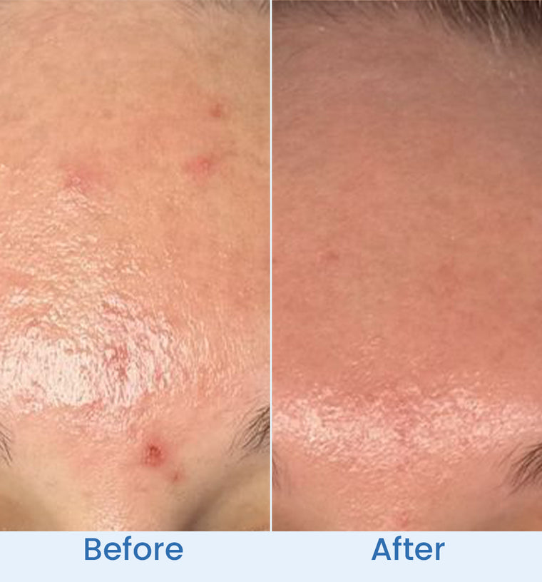 Shazia before and after